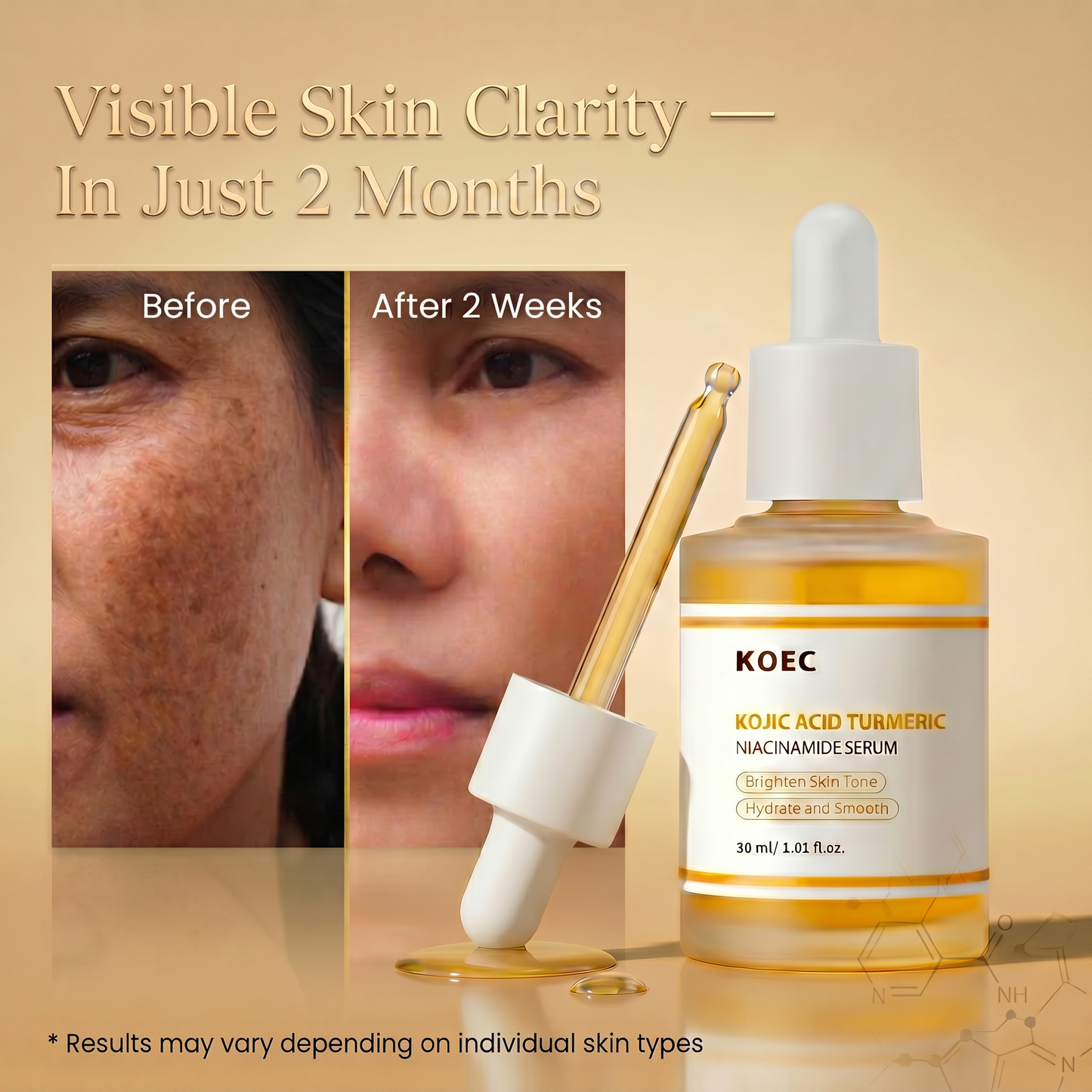KOEC Kojic Acid Turmeric Serum